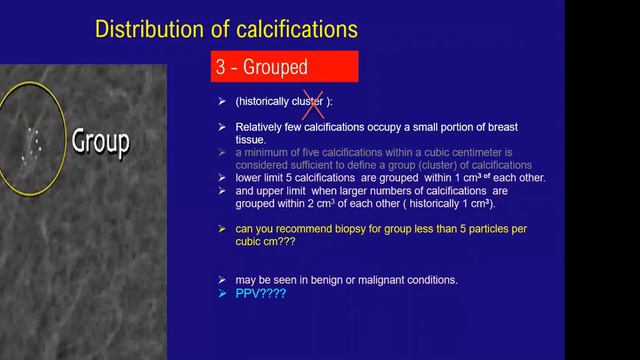 Lec- 9 Systemic mammographic Approach to calcification- 27/ 11 / 2020 смотреть онлайн