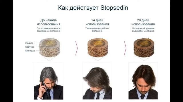 Спрей стопседин - отзывы смотреть онлайн