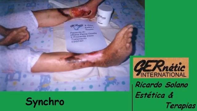 Fechamento Úlcera смотреть онлайн