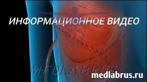 Рак груди-хирургическое удаление опухоли