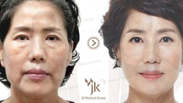 Пластическая хирургия в Южной Корее , все виды пластических операций в Корее (пластика в Корее) смотреть онлайн