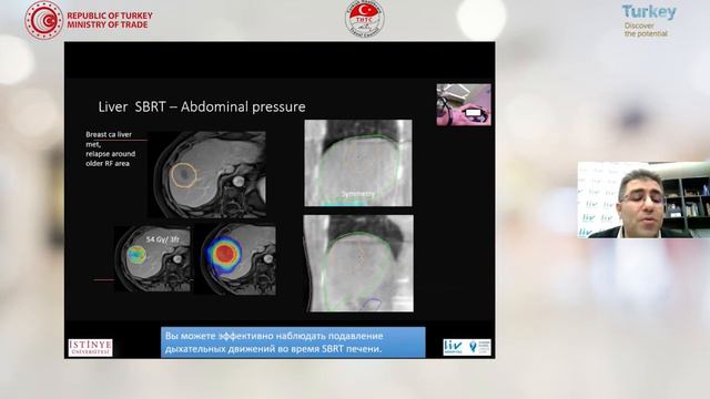 05.02, 10:30-11:00 ▪ Radiation Therapy with SRS and IMRT. 4D Prostate Brachytherapy смотреть онлайн