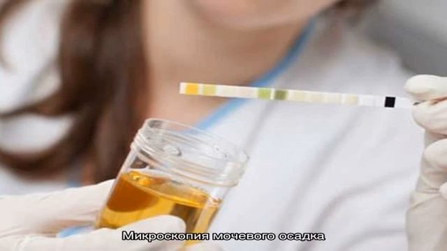 Микроскопия мочи