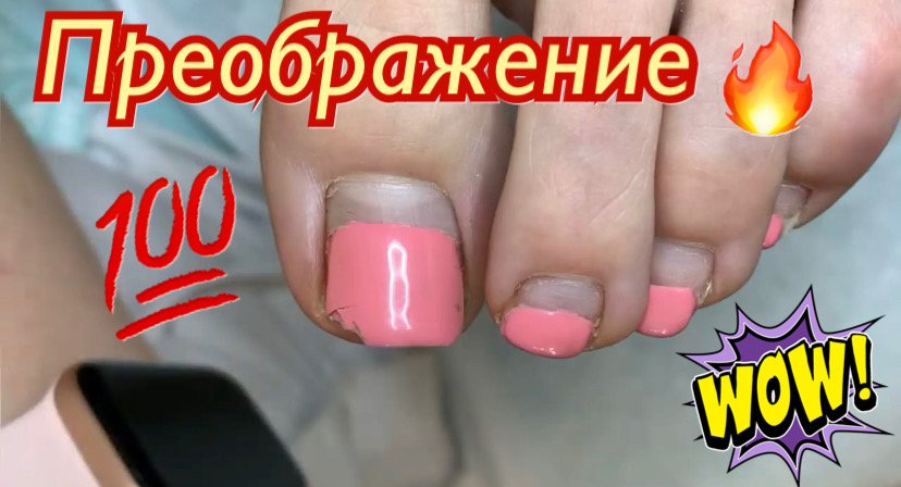 Преображение ???? смотреть онлайн