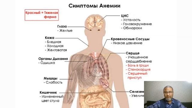 Хиджама. Головные боли.