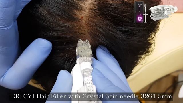 Dr CYJ Hair Filler Injection Avec Crystal Multineedle 5 Aiguilles