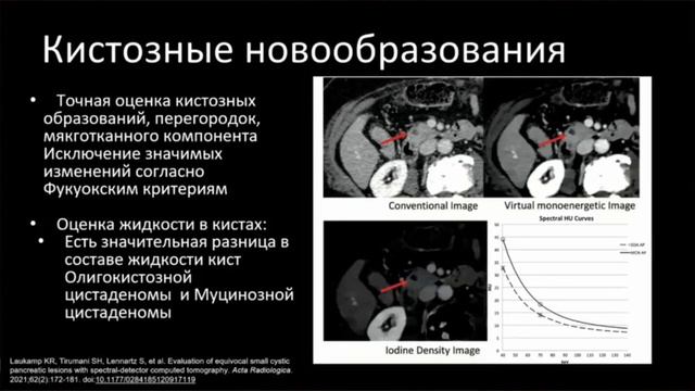КТ в диагностике заболеваний поджелудочной железы: новые тренды - Кондратьев Евгений Валерьевич смотреть онлайн