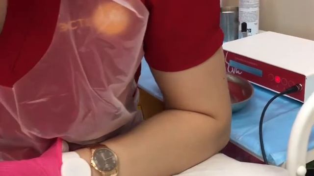 Атравматичный аппарат ЕВА Красивое лицо всегда смотреть онлайн