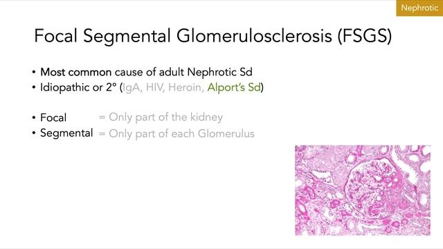 PAL - Renal lecture part 2 (Acid-base, Nephrotic and Nephritic Syndromes, Renal Cancer) смотреть онлайн