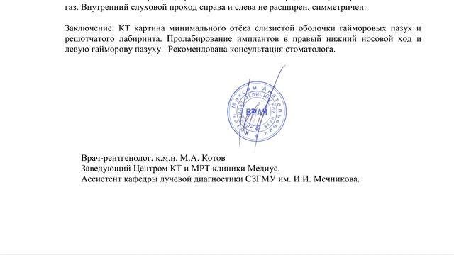 ОТЕК СЛИЗИСТОЙ носа на РАСШИФРОВКЕ КТ придаточных пазух. Отек слизистой ГАЙМОРОВЫХ пазух. смотреть онлайн