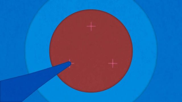 What Is a Hernia and How Is One Repaired? смотреть онлайн