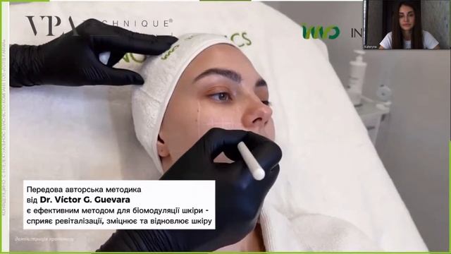 Пілінг MCA 35 – безінʼєкційна біоревіталізація і експрес ліфтинг. смотреть онлайн