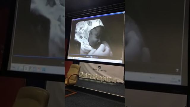 Ролик про мягкое кесарево на конференции «Роды с рубцом» в ПМЦ смотреть онлайн
