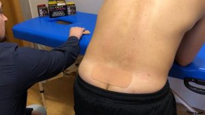 Наложение кинезио тейпа на крестцо́во-подвздо́шный суста́в