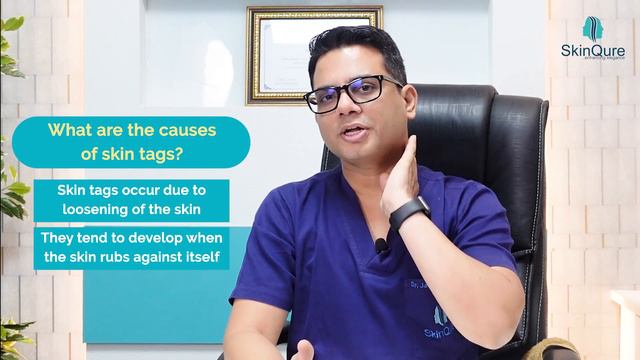 Know all about Skin Tags | Skin Tags Treatment in Delhi | SkinQure смотреть онлайн
