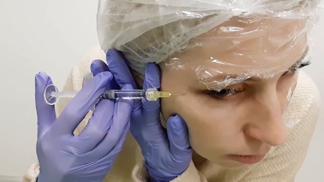 Как сделать биоревитализацию самой себе - видео урок смотреть онлайн