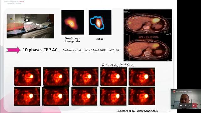 Роль рентгенолога в процессе мультимодального планирования лучевой терапии смотреть онлайн