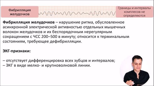 ЭКГ за 100 минут №4: Нарушения ритма на ЭКГ смотреть онлайн
