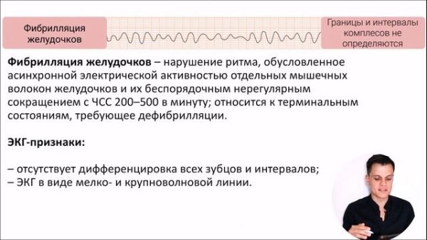 ЭКГ за 100 минут №4: Нарушения ритма на ЭКГ
