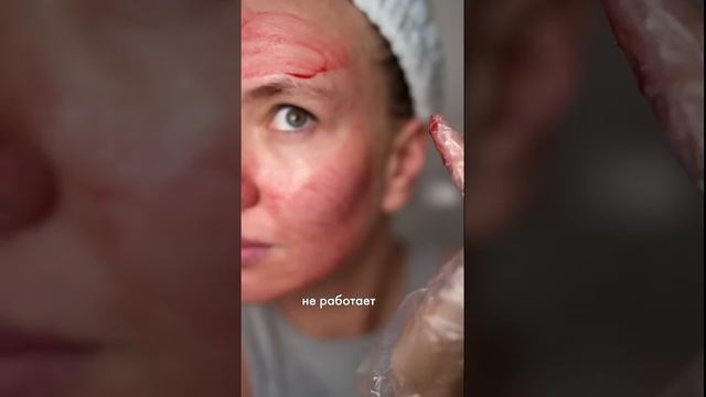 Пилинг The Ordinary — помогает от пятен после прыщей и выравнивает тон кожи #theordinary #прыщи смотреть онлайн