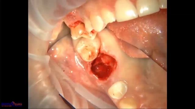 2018 08 07 ХАБИЕВ К Продажа дорогостоящих услуг в условиях кризиса смотреть онлайн