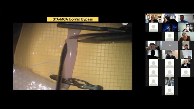 İON 91. ZOOM lecture, Başkaya: Mikrocerrahi Eğitimi 06.02.2021 смотреть онлайн