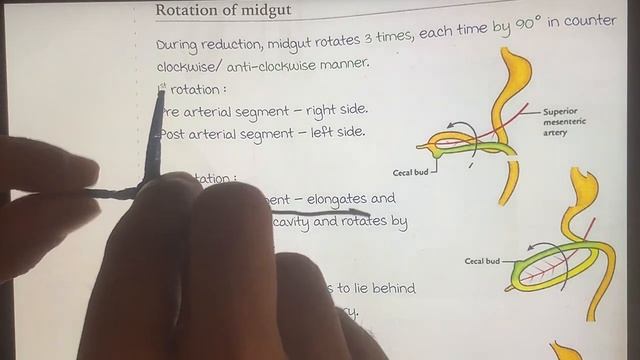 midgut rotation embryology | rotation of midgut embryology | development of midgut embryology смотреть онлайн
