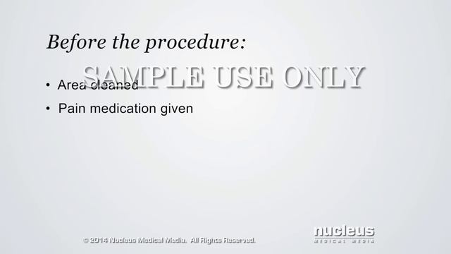 Circumcision | Nucleus Health