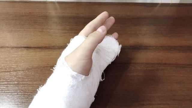 Короче говоря сломал ( палец) :(((((((( смотреть онлайн