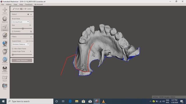 Cleaning/trimming and repairing stl files(dental models) in Meshmixer смотреть онлайн