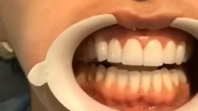 До и после смотреть онлайн