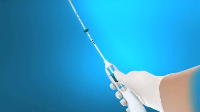 Animation For Insertion Of Mirena IUD