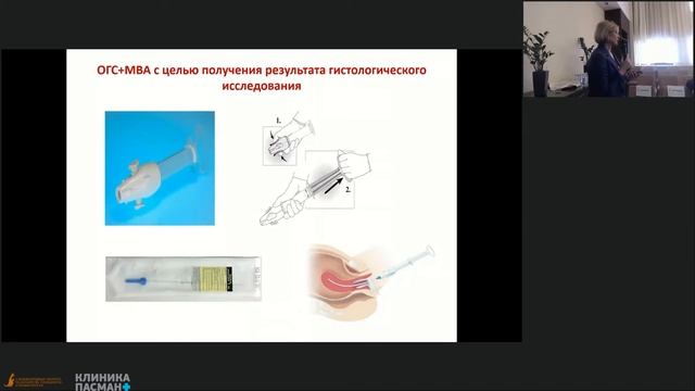 Ёлгина С.И. Офисная гистероскопия. Сложности внедрения VМеждународный конгресс 24.04 Зал 3 смотреть онлайн