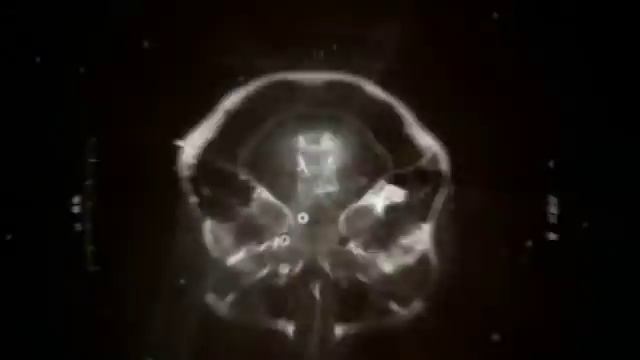 All 3 House M.D Openers/themes/intros (American, Singaporean And European)