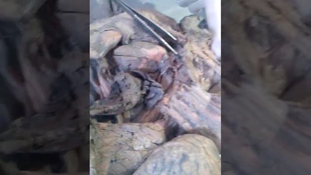 Сосудики головы, шеи смотреть онлайн