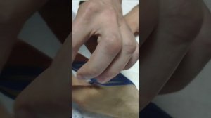 Тейпирование пальца после перелома.