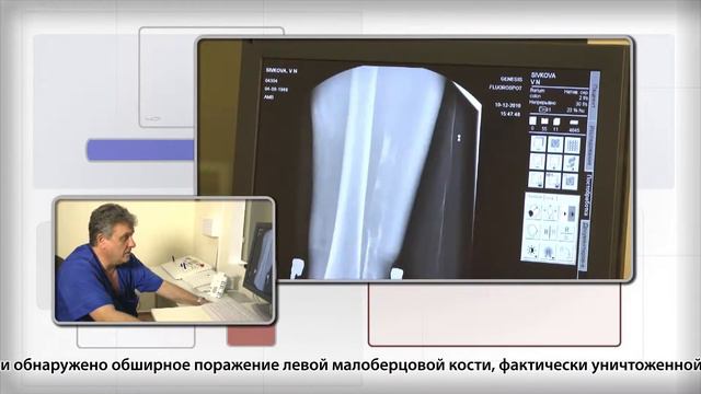 Цифровая рентген-диагностика 3 смотреть онлайн