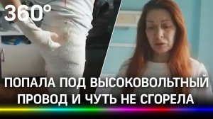 «Её трясло, одежда расплавилась: москвичка чуть не сгорела заживо из-за оборвавшейся ЛЭП