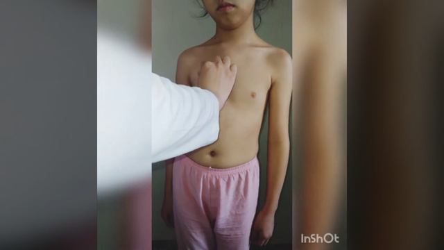 Топографиялық перкуссия 💉🏥 смотреть онлайн