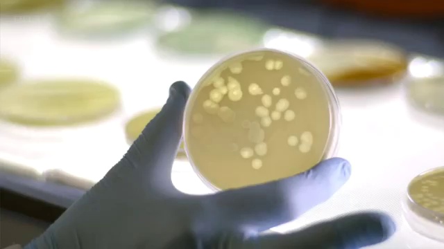 gsuperbug смотреть онлайн