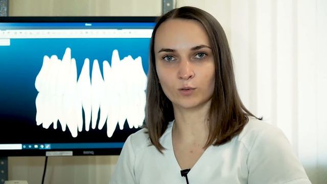 Брекет-система Insignia | СЦ «Дентика» смотреть онлайн