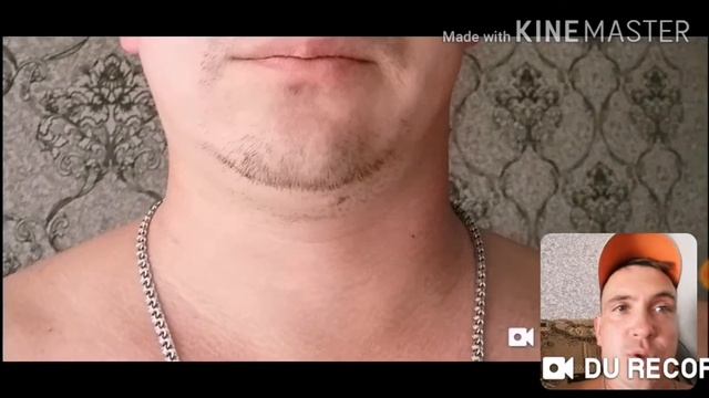 Не растёт борода мечты в 34 года смотреть онлайн