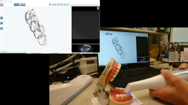 2018 mirdc video base intraoral scanner смотреть онлайн