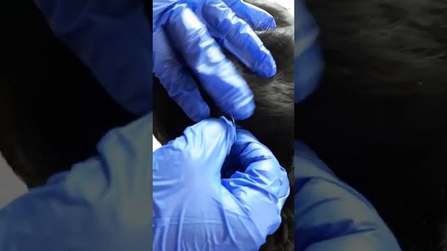 Как вытащить клеща у собаки. смотреть онлайн