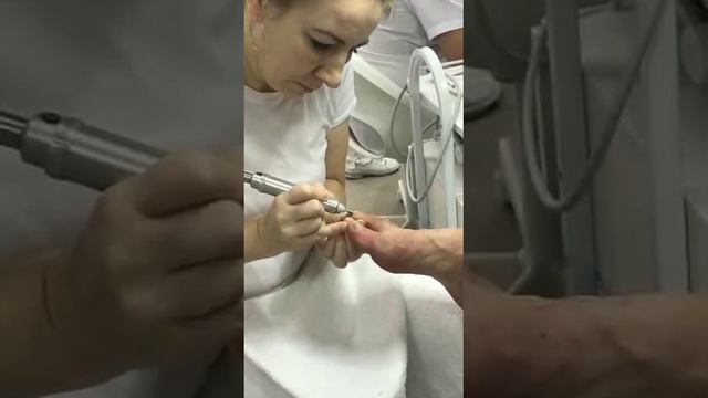 Подологический педикюр - Подолог
