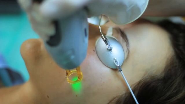 Лазерное омоложение смотреть онлайн