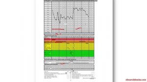 Методы Распознавания Плодности (МРП) - Урок1, Часть2.