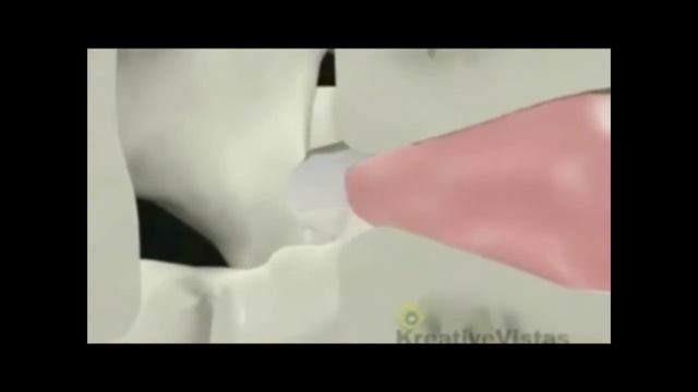 межпозвонковая грыжа возникновение и причина смотреть онлайн