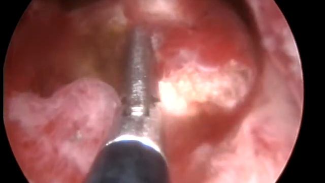 Mioma G1 смотреть онлайн