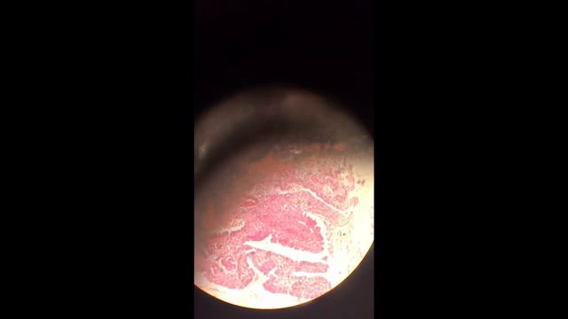 PATHOLOGY 2 || Microscope slides || 20 смотреть онлайн